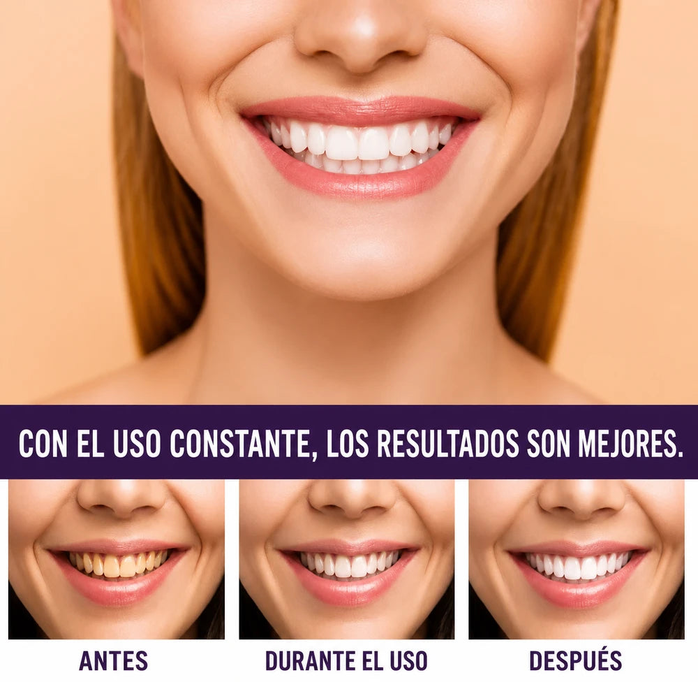 CREMA MORADA BLANQUEADOR DENTAL