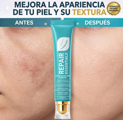 SCAR CREAM | ¿CANSADO DE VER ESAS MARCAS EN TU PIEL?